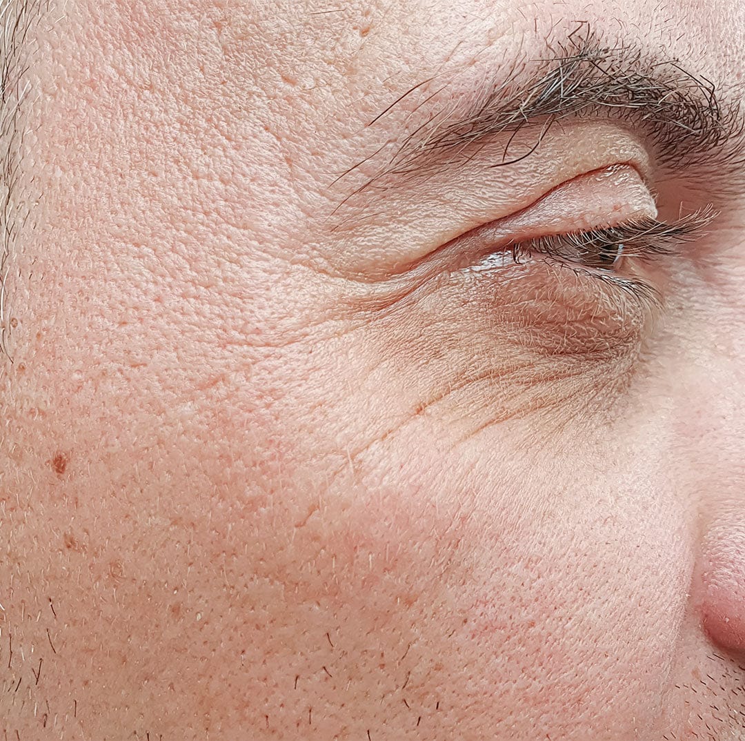 Antes de usar el colágeno de The Everyday Lab — contorno de ojos, día 1