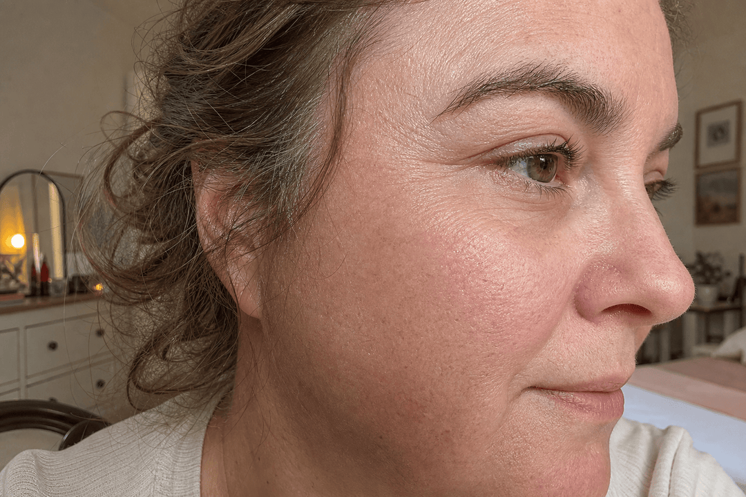 Después de 60 días usando el colágeno de The Everyday Lab — contorno de ojos